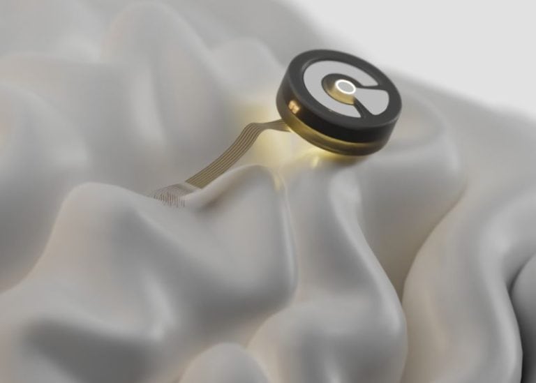 Malattie neurologiche: SiNAPS di Corticale e Intelligenza Artificiale per mappare il cervello “cellula per cellula”